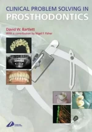 Clinical problem solving in prosthodontics by David W Bartlett