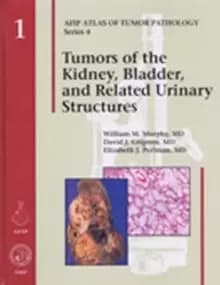 Tumors of the Kidney, Bladder, and Related Urinary Structures