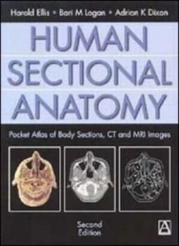 Human Sectional Anatomy by Adrian Dixon Book