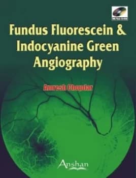 Fundus Fluorescein and Indocyanine Green Angiography by Amresh Chopdar Hardback