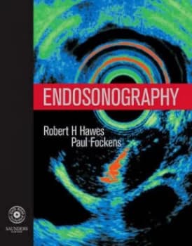 Endosonography by Robert H Hawes Hardback