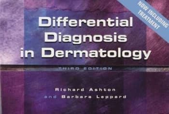 Differential Diagnosis in Dermatology by Norman J. Vetter Paperback
