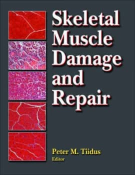 Skeletal Muscle Damage and Repair by Peter M Tiidus Hardback