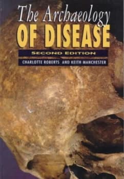 The Archaeology of Disease by Charlotte a Roberts and Keith Manchester Paperback