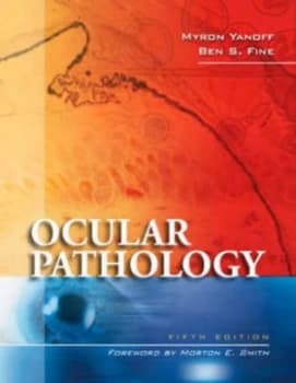 Ocular Pathology by Myron Yanoff Hardback