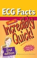ecg facts made incredibly quick