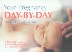 Day-by-Day by Stuart Campbell and Alison Mackonochie Paperback