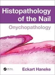 Histopathology of the Nail Onychopathology