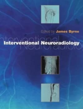Interventional Neuroradiology by J. V Byrne Book