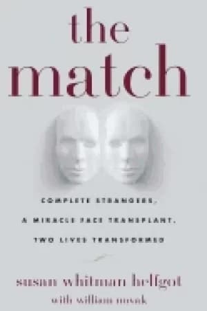 match complete strangers a miracle face transplant two lives transformed