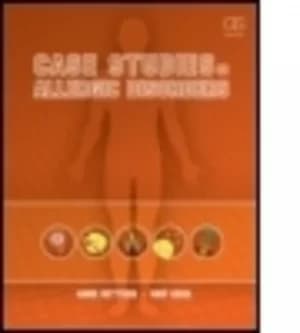 Case studies in allergic disorders by Hans Oettgen