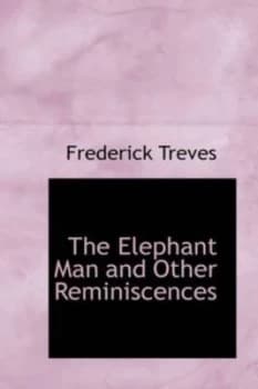 Elephant Man and Other Reminiscences by Sir Frederick Treves Paperback