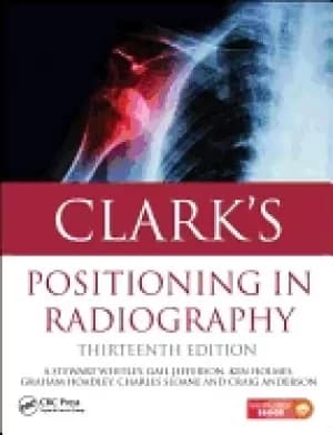 clarks positioning in radiography 13th edition