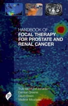 Handbook of focal therapy for prostate and renal cancer by Truls E. Bjerklund Johansen
