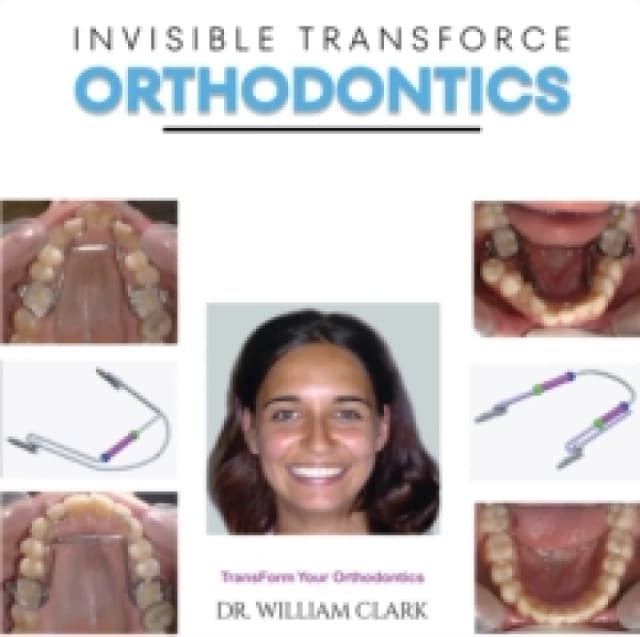 Invisible TransForce Orthodontics Paperback / softback