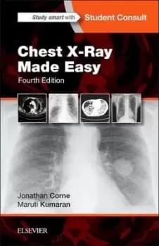 Chest X-Ray Made Easy by Jonathan Corne