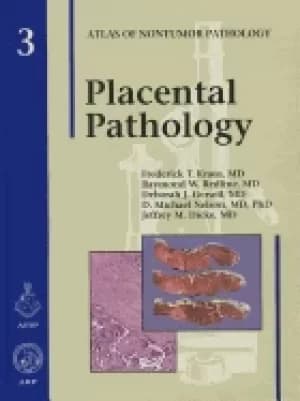 placental pathology