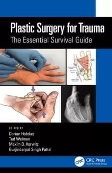 Plastic Surgery for TraumaThe Essential Survival Guide