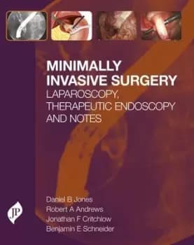 Minimally Invasive SurgeryLaparoscopy Therapeutic Endoscopy and NOTES