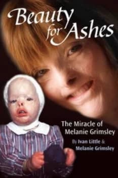 Beauty for Ashes by Ivan Little and Melanie Grimsley Paperback