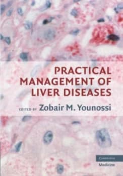 Practical Management of Liver Diseases by Zobair M. Younossi Hardback