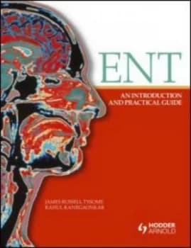 Ent by James Russell Tysome Paperback