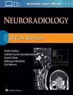 neuroradiology a core review