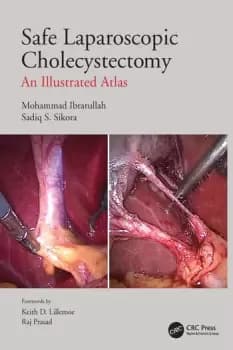 Safe Laparoscopic CholecystectomyAn Illustrated Atlas