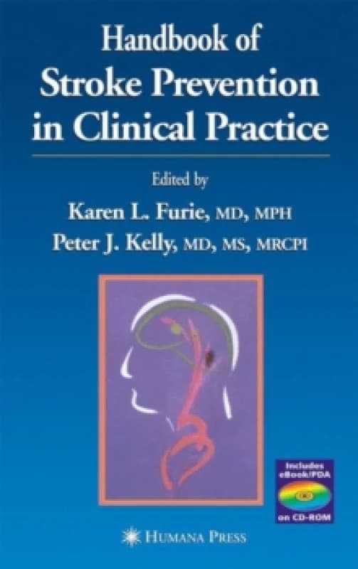 Handbook of Stroke Prevention in Clinical Practice Hardback