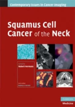 Squamous Cell Cancer of the Neck by Robert Hermans Hardback