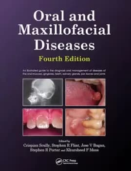 Oral and Maxillofacial Diseases Fourth Edition
