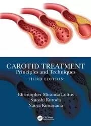 Carotid Treatment: Principles and Techniques