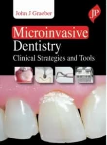 Microinvasive Dentistry : Clinical Strategies and Tools