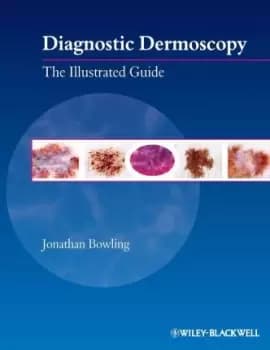 Diagnostic Dermoscopy by Jonathan Bowling