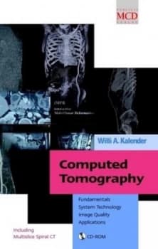 Computed Tomography by Willi A. Kalender Hardback