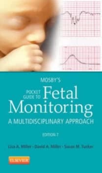 Mosbys Pocket Guide to Fetal Monitoring by Lisa a Miller Paperback