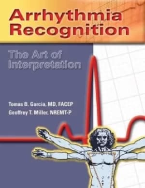 Arrhythmia recognition by Tomas B Garcia
