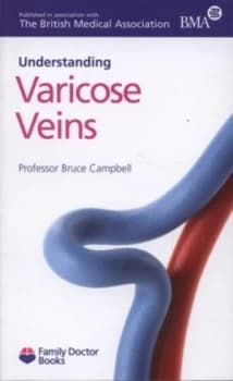Understanding Varicose Veins by Bruce Campbell Paperback