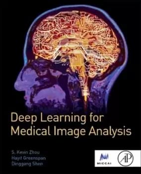 Deep Learning for Medical Image Analysis by S. Kevin Zhou