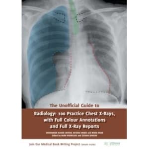 The Unofficial Guide to Radiology : 100 Practice Chest X-Rays
