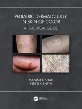 Pediatric Dermatology in Skin of ColorA Practical Guide