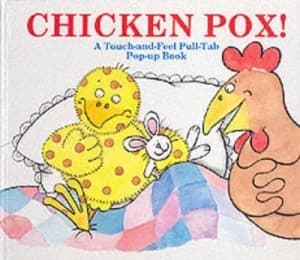 Chicken Pox by Shen Roddie and Frances Cony Book