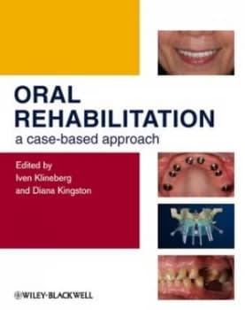 Oral Rehabilitation by Iven Klineberg Hardback