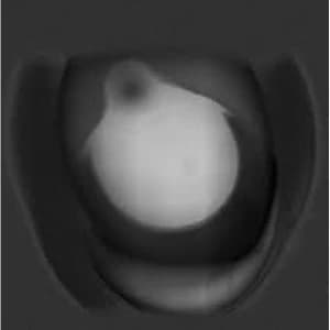 Flies+Flies - Milk & Peppers Vinyl