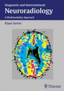 Neuroradiology by Klaus Sartor Hardback