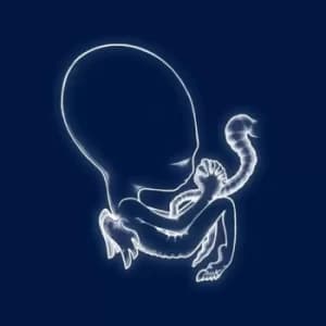 Sigur Rós ‎- Ágaetis Byrjun Vinyl