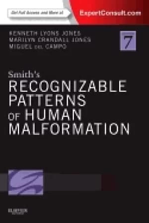 smiths recognizable patterns of human malformation expert consult online an