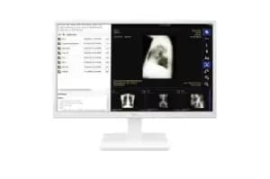 LG 24CK560N-3A All-in-One PC/workstation AMD G 60.5cm (23.8")...