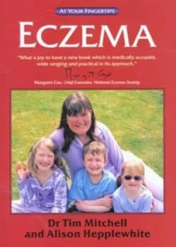 Eczema by Tim Mitchell and Alison Hepplewhite Book