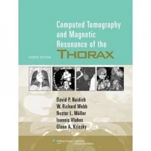 Computed Tomography and Magnetic Resonance of the Thorax by David P. Naidich Hardback